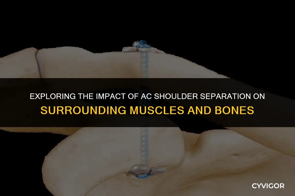 does ac shoulder separation affect other muscles bones