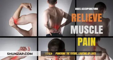 Acupuncture for Muscle Pain Relief: Effective Treatment or Myth?