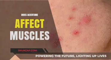 Exploring Accutane's Impact on Muscle Health: What You Need to Know