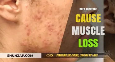 Accutane's Impact: Muscle Loss and Bodybuilding Setbacks