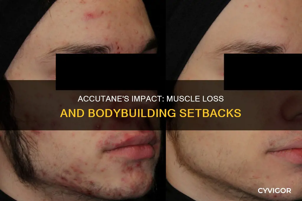 does accutane cause muscle loss