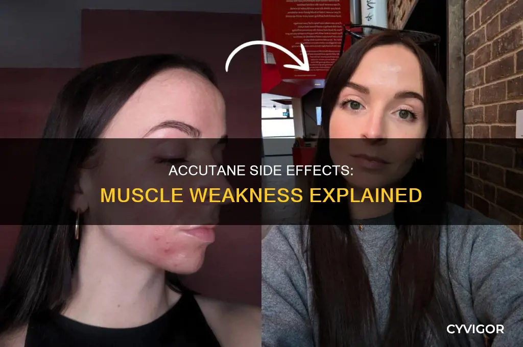 does accutane cause muscle weakness