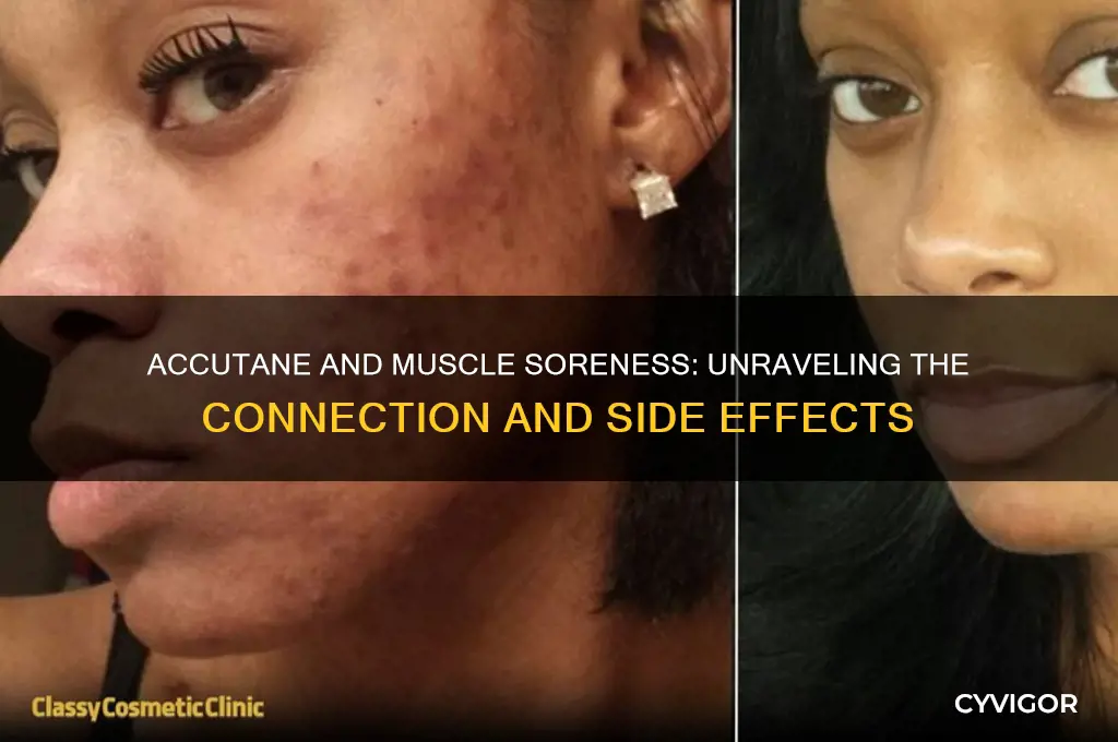 does accutane make your muscles sore