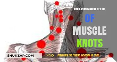 Unraveling Muscle Knots: The Ancient Art of Acupuncture