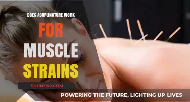 Acupuncture for Muscle Strains: Effective Relief or Just a Myth?