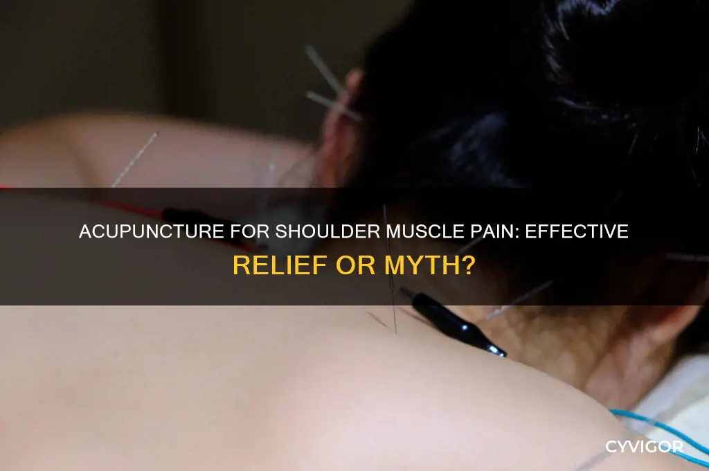 does acupuncture work for shoulder muscle pain