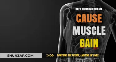 Addison's Disease: Can It Cause Muscle Gain?