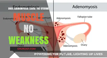 Adenomyosis: Weakened Uterine Muscles and Their Connection