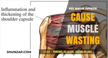 Adhesive Capsulitis: Does it Cause Muscle Wasting?