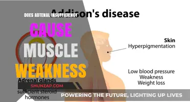 Adrenal Insufficiency: Can It Cause Muscle Weakness?