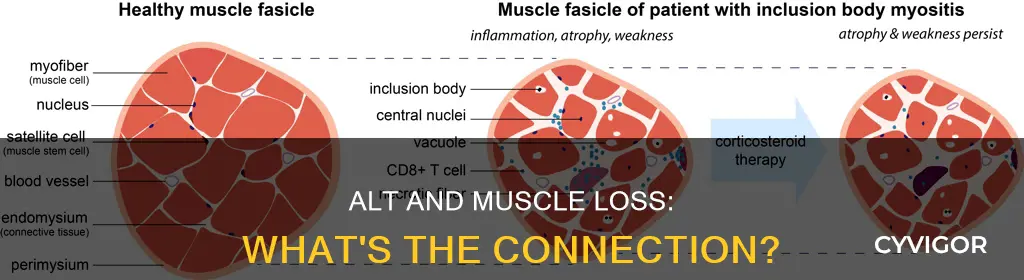 does alt remove muscle