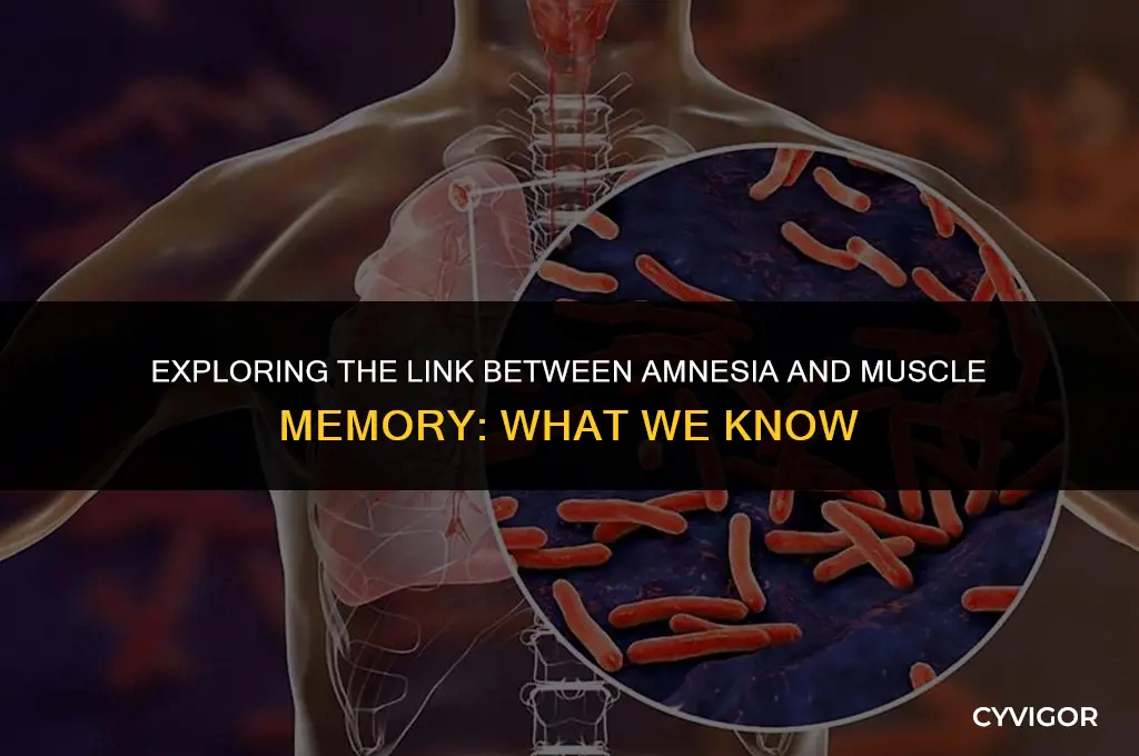 does amnesia affect muscle memory