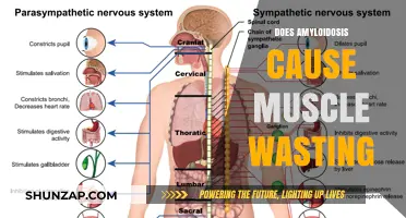 Amyloidosis and Muscle Wasting: What's the Link?