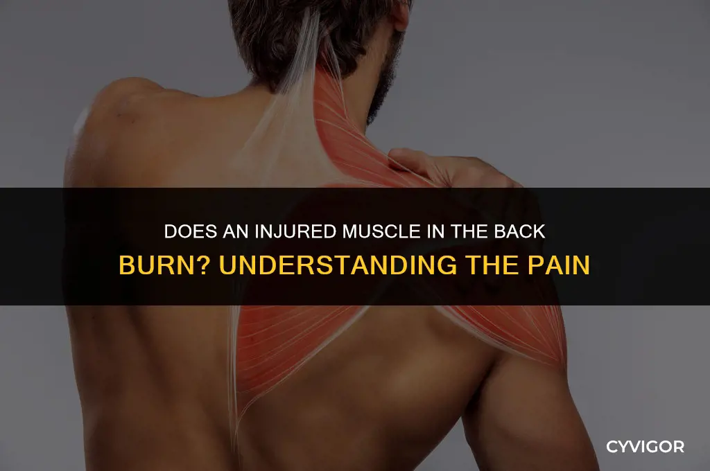 does an injured muscle in the back burn