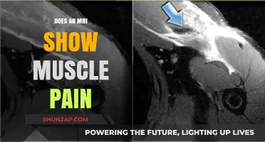 Can MRI Detect Muscle Pain? Understanding Imaging and Discomfort