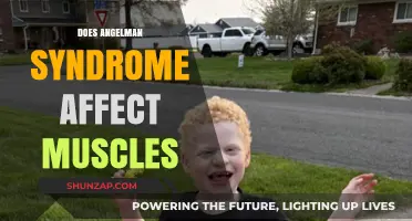 Exploring the Impact of Angelman Syndrome on Muscle Function