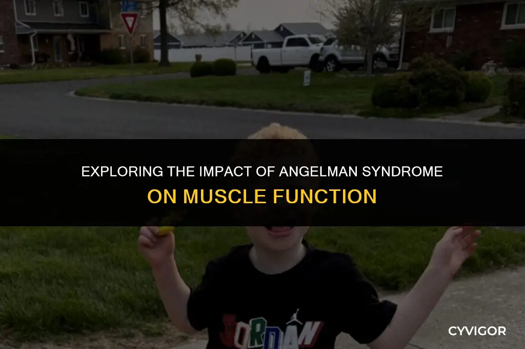 does angelman syndrome affect muscles