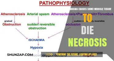 Angina and Necrosis: Understanding the Link