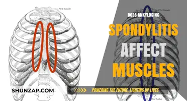 Exploring the Impact of Ankylosing Spondylitis on Muscle Health