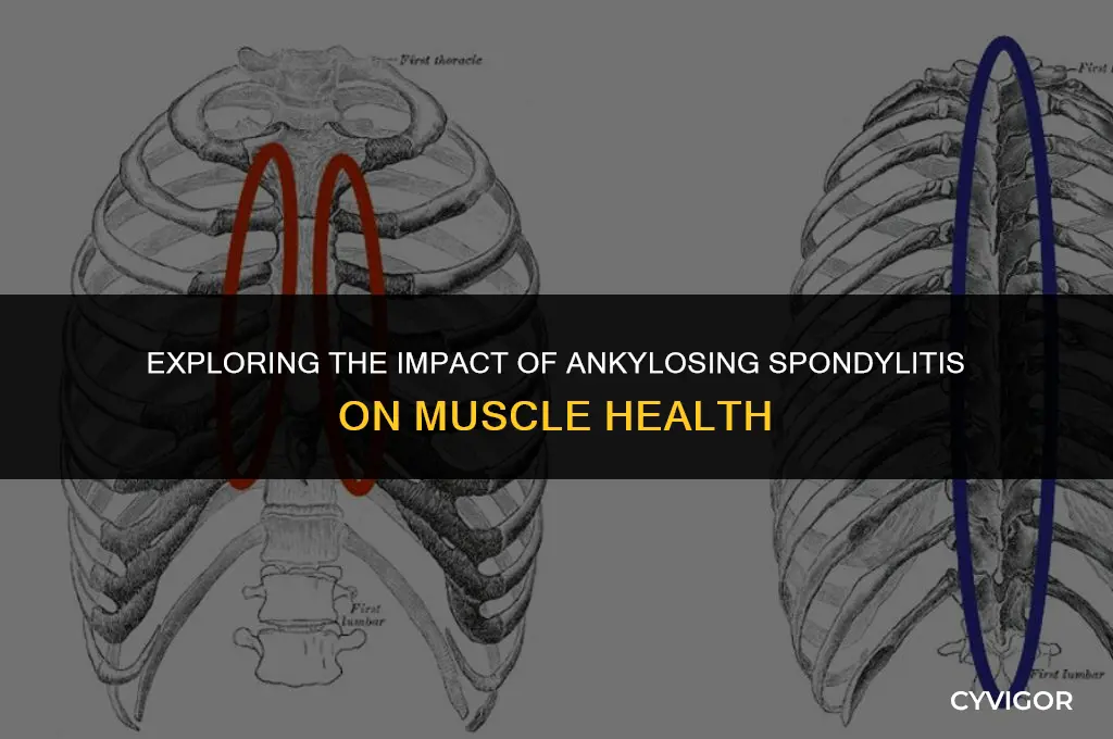 does ankylosing spondylitis affect muscles