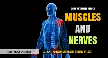 Exploring Arthritis: Its Impact on Muscles and Nerves