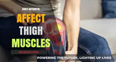 Exploring Arthritis: Impact on Thigh Muscles and Beyond
