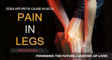 Arthritis and Leg Pain: Is It Muscle Aches?
