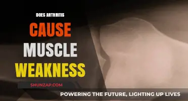 Arthritis and Muscle Weakness: Is There a Link?