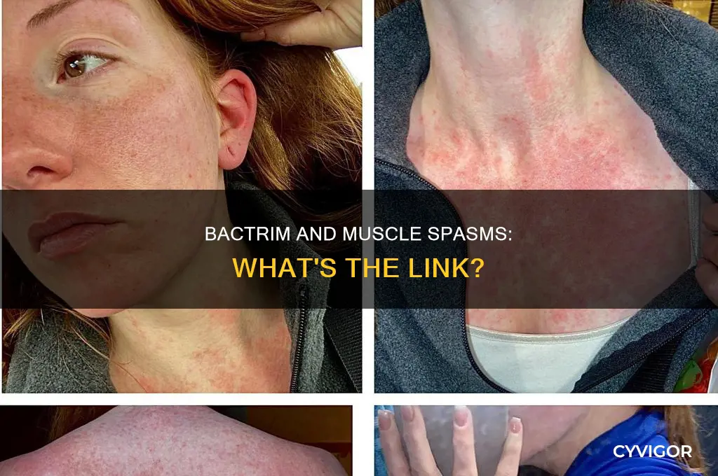 does bactrim cause muscle spasms
