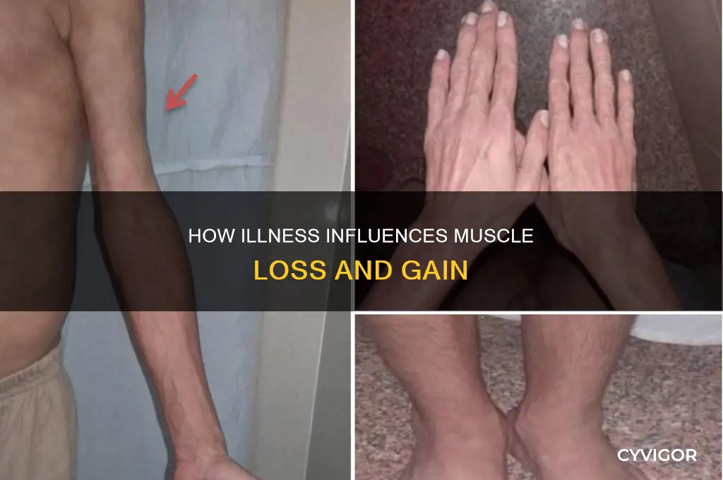 does being sick cause muscle loss
