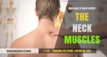 Exploring Bell's Palsy: Impact on Neck Muscles and Beyond
