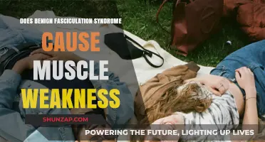 Benign Fasciculation Syndrome: Can It Weaken Muscles?