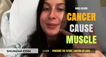 Blood Cancer and Muscle: Is There a Link?