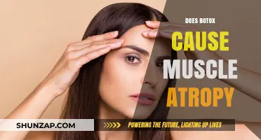 Botox and Muscle Atrophy: What's the Real Deal?