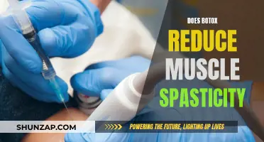 Botox Treatment: Reducing Muscle Spasticity and Improving Functionality
