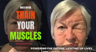 Botox and Muscle Memory: Can It Train Your Muscles?