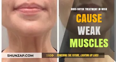 Botox Neck Treatment: Can It Weaken Muscles?