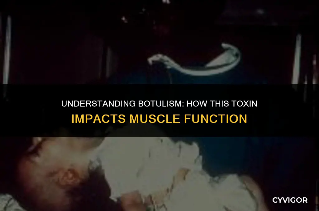 does botulism affect muscles