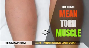 Bruising and Torn Muscles: What Does It Mean?
