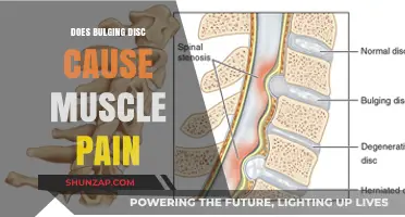 Bulging Disc: Understanding the Link to Muscle Pain