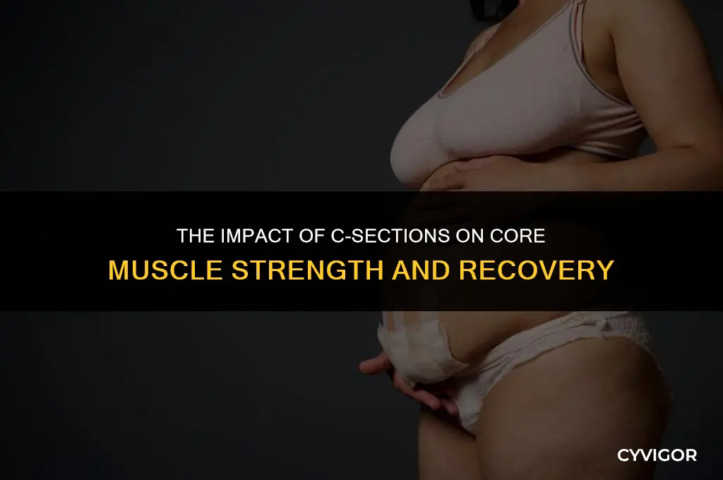 does c section affect core muscles