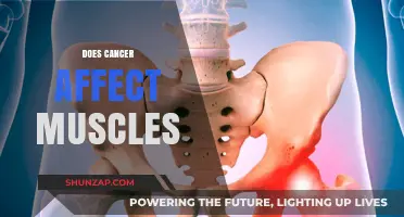 Understanding Cancer's Impact: Does It Affect Your Muscles?