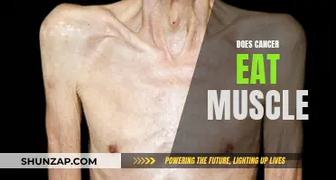 Cancer's Devastating Impact: Eating Away at Muscles