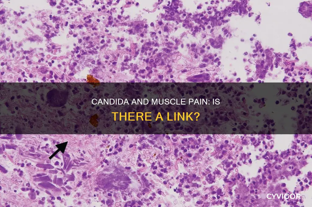 does candida cause muscle pain