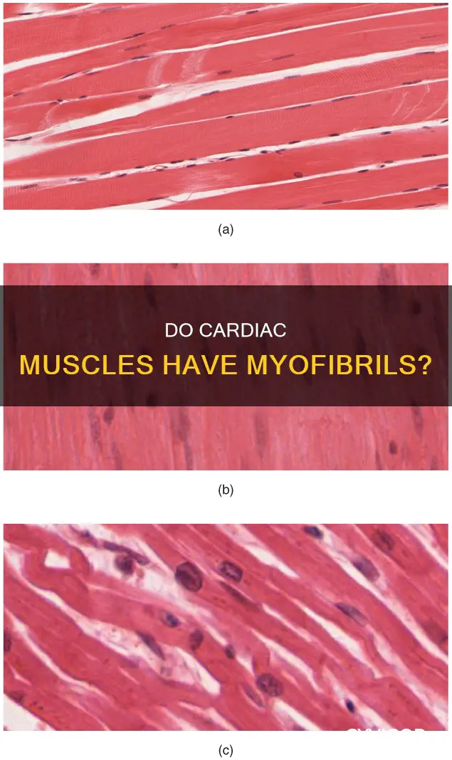 does cardiac muscle have myofibrils