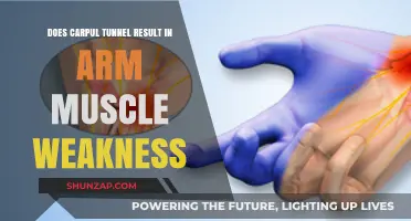 Carpal Tunnel Syndrome: Does It Cause Arm Muscle Weakness?