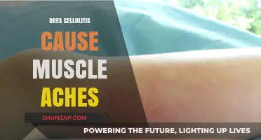 Cellulitis and Muscle Aches: What's the Link?