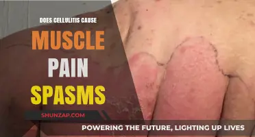 Cellulitis and Muscle Pain: Understanding the Spasms