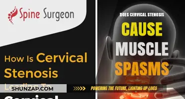 Cervical Stenosis and Muscle Spasms: Is There a Link?