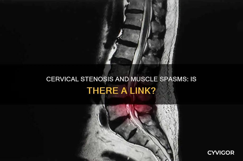 does cervical stenosis cause muscle spasms